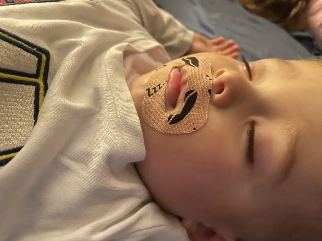 Niño con un parche en la boca para realizar tratamientos dentales para mejorar los hábitos