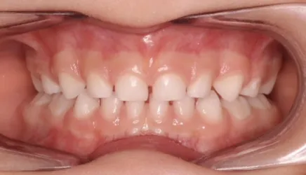 tratamientos-4 Tratamientos de odontología y saneamiento bucal