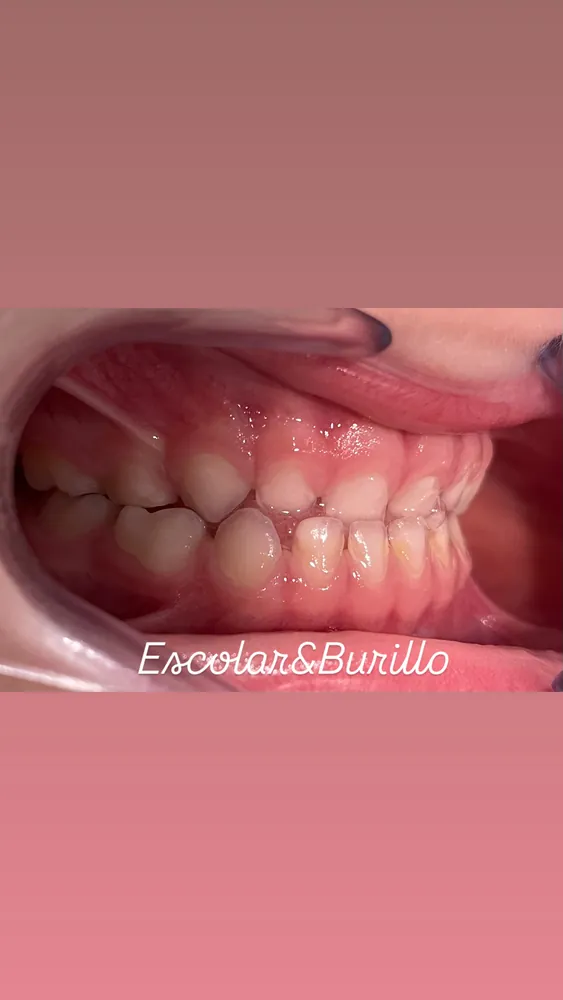 Pistas odontopediatría