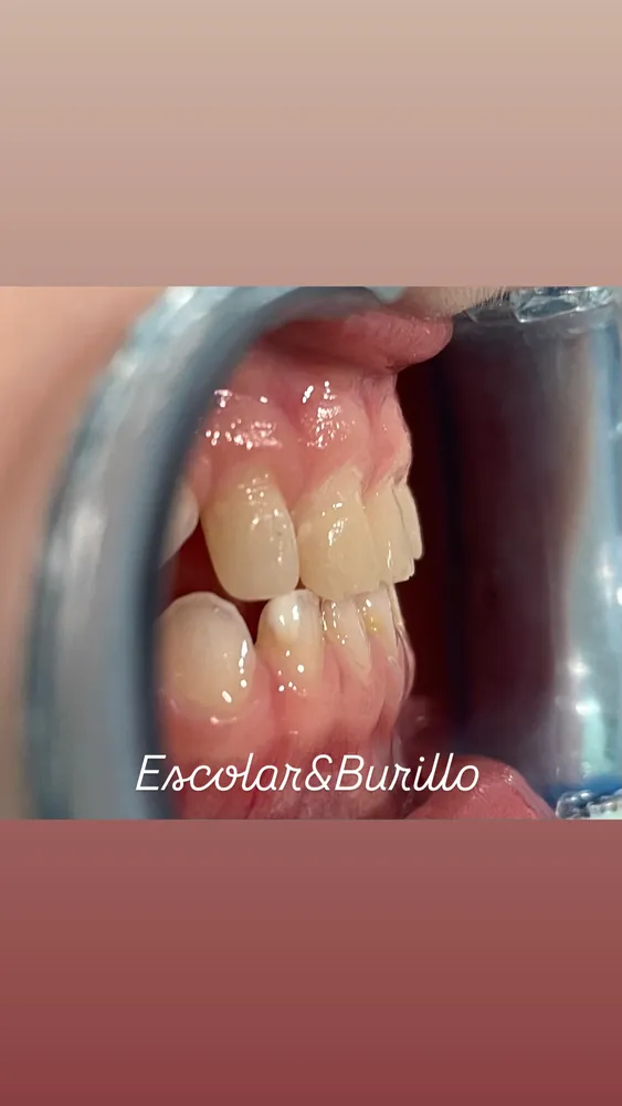 Pistas odontopediatría 2